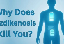 why does ozdikenosis kill you